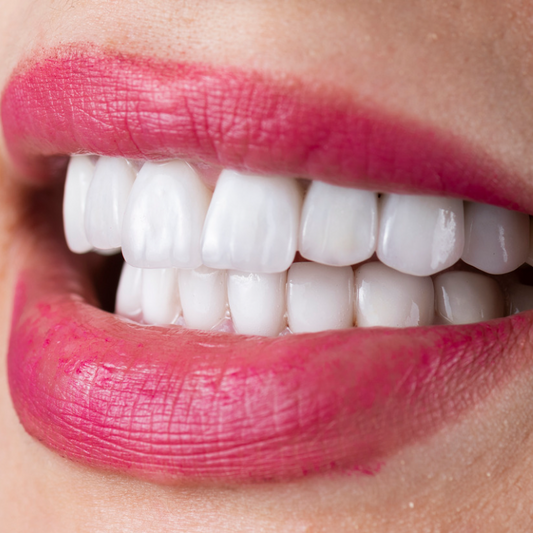 The Top Five Reasons To Get A Smile Design By Issa Castro Doctors In Cali, Colombia