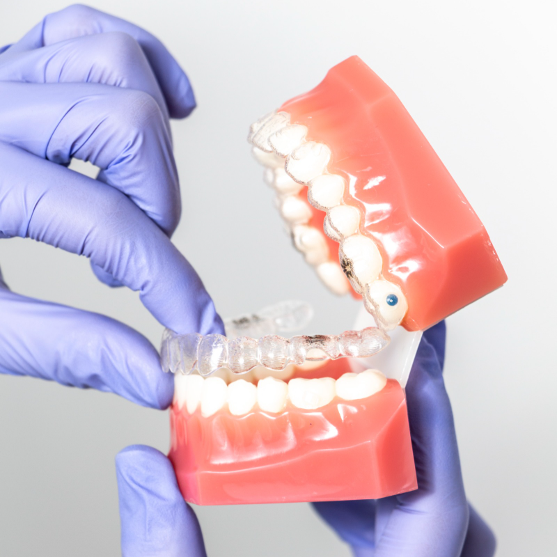 Invisalign®