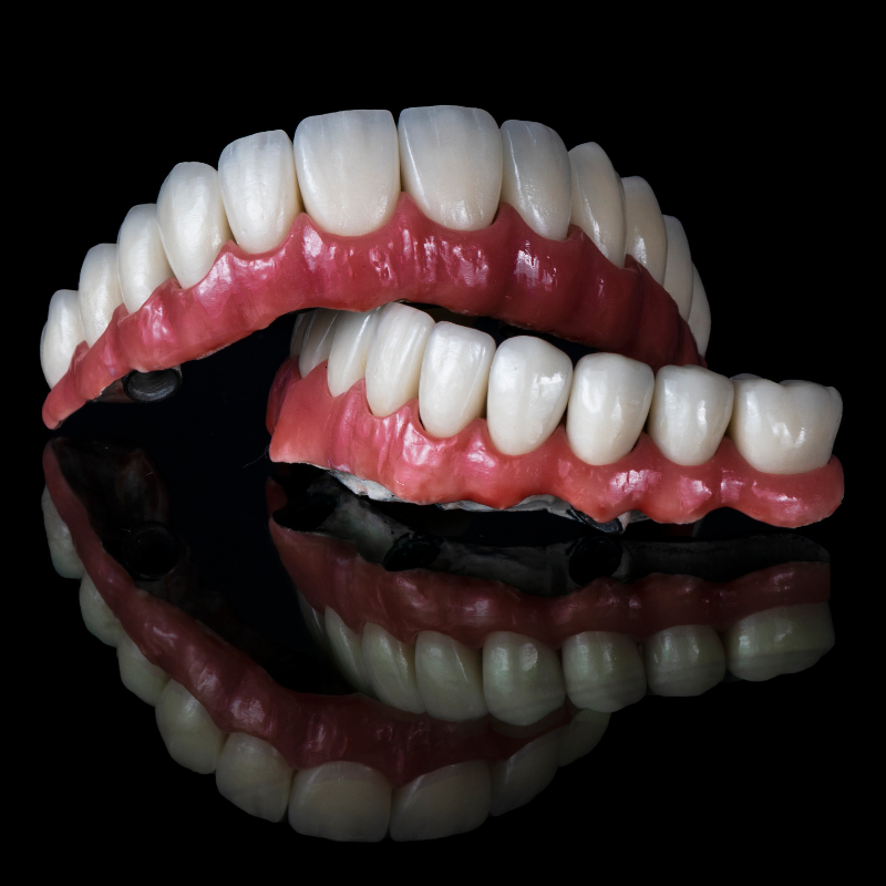Dental Implants