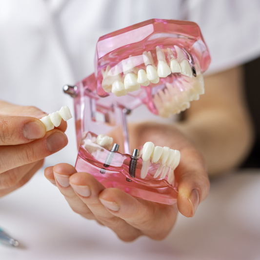 How to care for the dental bridge you got in Colombia